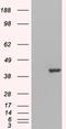 GRB2 Related Adaptor Protein 2 antibody, NB100-805, Novus Biologicals, Western Blot image 