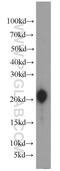 Gastrokine-1 antibody, 14494-1-AP, Proteintech Group, Western Blot image 