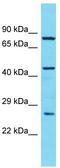 Coiled-Coil Domain Containing 34 antibody, TA333559, Origene, Western Blot image 