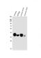 Mitochondrially Encoded NADH:Ubiquinone Oxidoreductase Core Subunit 2 antibody, A32839-1, Boster Biological Technology, Western Blot image 
