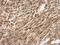 Solute Carrier Family 25 Member 11 antibody, NBP2-20385, Novus Biologicals, Immunohistochemistry paraffin image 