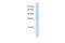 Fibronectin Type III Domain Containing 3B antibody, A06614, Boster Biological Technology, Western Blot image 