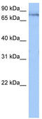 Tetratricopeptide Repeat Domain 14 antibody, TA343979, Origene, Western Blot image 