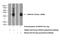 Annexin A10 antibody, 15588-1-AP, Proteintech Group, Western Blot image 