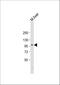 Prospero Homeobox 1 antibody, A01985, Boster Biological Technology, Western Blot image 