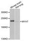 Myosin-7 antibody, A7564, ABclonal Technology, Western Blot image 