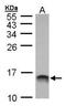 Macrophage Migration Inhibitory Factor antibody, GTX101162, GeneTex, Western Blot image 