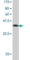 Transcription factor SOX-4 antibody, H00006659-A01, Novus Biologicals, Western Blot image 