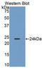 Orosomucoid 2 antibody, LS-C300828, Lifespan Biosciences, Western Blot image 