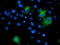 Asparagine Synthetase (Glutamine-Hydrolyzing) antibody, LS-C173259, Lifespan Biosciences, Immunofluorescence image 