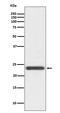 WAP Four-Disulfide Core Domain 2 antibody, M02685-1, Boster Biological Technology, Western Blot image 