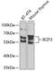 IKAROS Family Zinc Finger 3 antibody, GTX64869, GeneTex, Western Blot image 