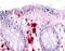 Macrophage Stimulating 1 Receptor antibody, orb85863, Biorbyt, Immunohistochemistry paraffin image 