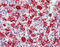 Heme Oxygenase 1 antibody, MBS565209, MyBioSource, Immunohistochemistry paraffin image 