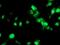 SET Domain Containing 7, Histone Lysine Methyltransferase antibody, NBP2-01066, Novus Biologicals, Immunofluorescence image 
