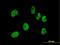 Cleavage And Polyadenylation Specific Factor 7 antibody, H00079869-B01P, Novus Biologicals, Immunofluorescence image 