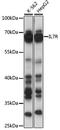 Interleukin 7 Receptor antibody, LS-C748550, Lifespan Biosciences, Western Blot image 