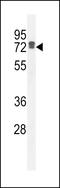 Leucine Rich Repeat Containing 40 antibody, LS-C165859, Lifespan Biosciences, Western Blot image 