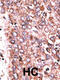 Cellular Communication Network Factor 6 antibody, 62-201, ProSci, Immunohistochemistry paraffin image 