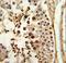 Protein Phosphatase 3 Regulatory Subunit B, Beta antibody, LS-C162093, Lifespan Biosciences, Immunohistochemistry paraffin image 