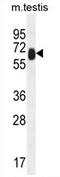 Tetratricopeptide Repeat Domain 39B antibody, AP54399PU-N, Origene, Western Blot image 