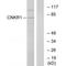 Connector enhancer of kinase suppressor of ras 1 antibody, A08845, Boster Biological Technology, Western Blot image 