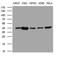 Ceramide Synthase 2 antibody, M03175, Boster Biological Technology, Western Blot image 