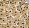 ABL Proto-Oncogene 1, Non-Receptor Tyrosine Kinase antibody, LS-C99162, Lifespan Biosciences, Immunohistochemistry paraffin image 