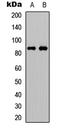 Fibroblast Growth Factor Receptor Substrate 2 antibody, LS-C356038, Lifespan Biosciences, Western Blot image 
