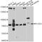 Procollagen-Lysine,2-Oxoglutarate 5-Dioxygenase 3 antibody, A10547, ABclonal Technology, Western Blot image 