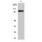 Mitogen-Activated Protein Kinase 6 antibody, LS-C383409, Lifespan Biosciences, Western Blot image 