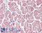 SLIT And NTRK Like Family Member 6 antibody, LS-A9246, Lifespan Biosciences, Immunohistochemistry paraffin image 