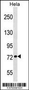 Kinesin Family Member 3B antibody, 59-058, ProSci, Western Blot image 