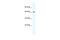 Calcium Voltage-Gated Channel Auxiliary Subunit Beta 2 antibody, 28-222, ProSci, Western Blot image 