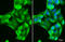 Glutathione S-Transferase Alpha 1 antibody, GTX113722, GeneTex, Immunocytochemistry image 