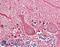 Mitochondrial Inner Membrane Protein MPV17 antibody, 42-674, ProSci, Western Blot image 
