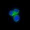 C-C Motif Chemokine Receptor 8 antibody, M03518, Boster Biological Technology, Immunohistochemistry paraffin image 