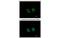 Interleukin 1 Receptor Type 2 antibody, MBS837562, MyBioSource, Immunofluorescence image 