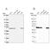 NADH:Ubiquinone Oxidoreductase Core Subunit S2 antibody, NBP2-30413, Novus Biologicals, Western Blot image 