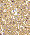 Hemoglobin Subunit Gamma 2 antibody, 61-039, ProSci, Immunohistochemistry paraffin image 