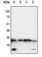 Tumor Necrosis Factor antibody, MBS820357, MyBioSource, Western Blot image 
