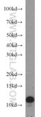 Vacuolar ATPase Assembly Factor VMA21 antibody, 21921-1-AP, Proteintech Group, Western Blot image 