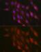 Beta-Transducin Repeat Containing E3 Ubiquitin Protein Ligase antibody, GTX55536, GeneTex, Immunocytochemistry image 