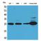 Ubiquitin C-Terminal Hydrolase L1 antibody, LS-C386912, Lifespan Biosciences, Western Blot image 