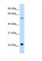 Sialin antibody, NBP1-59788, Novus Biologicals, Western Blot image 