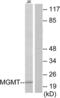 O-6-Methylguanine-DNA Methyltransferase antibody, LS-C119572, Lifespan Biosciences, Western Blot image 