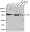 Chaperonin Containing TCP1 Subunit 2 antibody, GTX33535, GeneTex, Western Blot image 