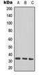 TAL BHLH Transcription Factor 1, Erythroid Differentiation Factor antibody, orb315818, Biorbyt, Western Blot image 