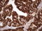 Keratin 16 antibody, LS-C791544, Lifespan Biosciences, Immunohistochemistry paraffin image 