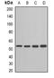 Adenylosuccinate Lyase antibody, LS-C482552, Lifespan Biosciences, Western Blot image 